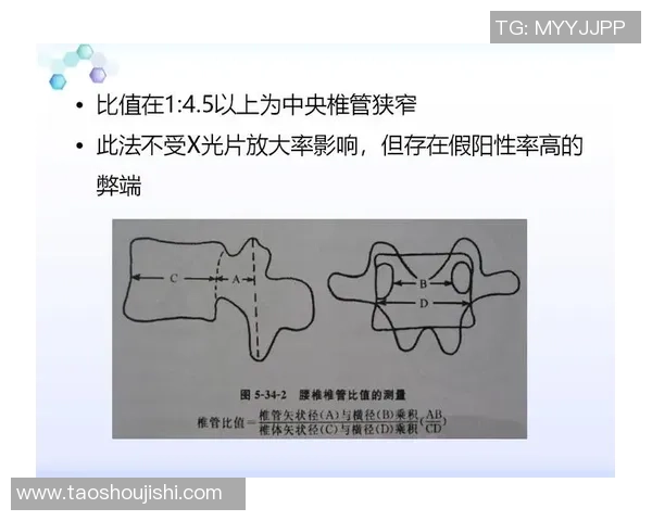 北京乒乓球队区域防守策略解析及其在比赛中的应用探讨 北京乒乓球队区域防守策略解析及其在比赛中的应用探讨